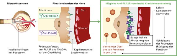 Autoimmunitat Bei Membranoser Nephropathie Anti Pla2r